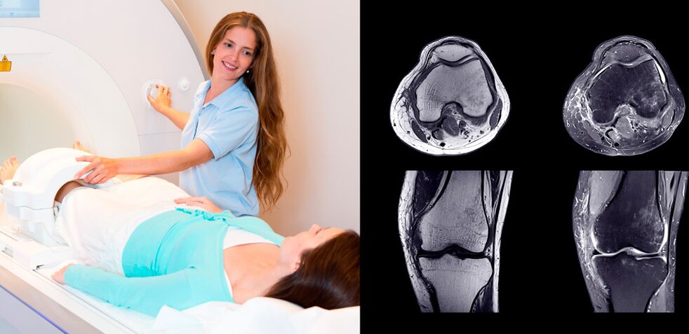 диагностика на колянна става