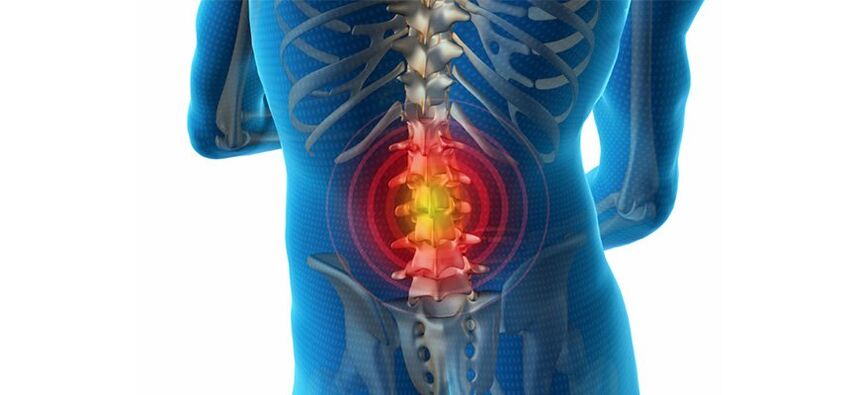 методи за диагностициране на болки в гърба